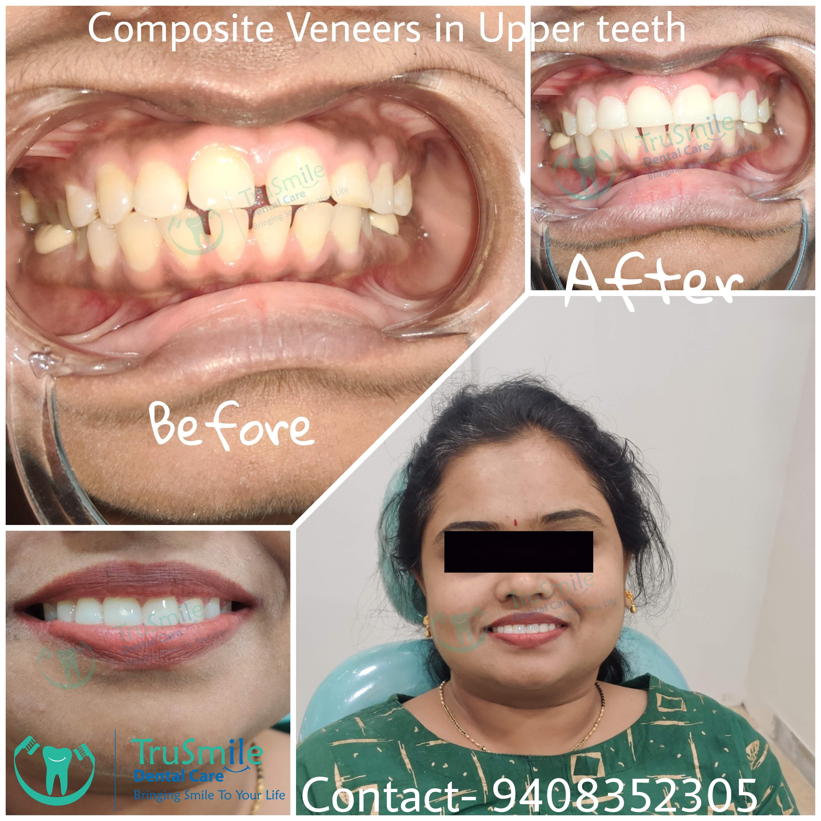 Smile Design 8